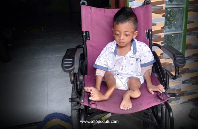 8 Kali Patah Kaki, Yuk… Bantu Abbrizam Biar Sehat Kembali